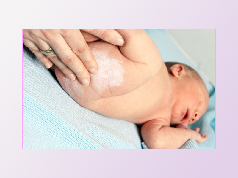 Sử dụng phấn rôm là một sai lầm khi trị hăm tã cho bé mà các bà mẹ cần tránh